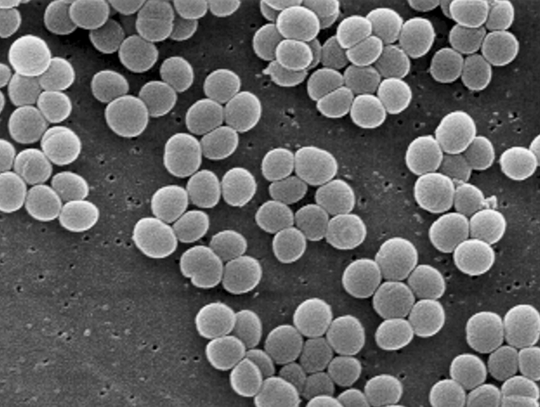 Bushnell-Prairie City HS Addresses Staph Infection Cases Among Students