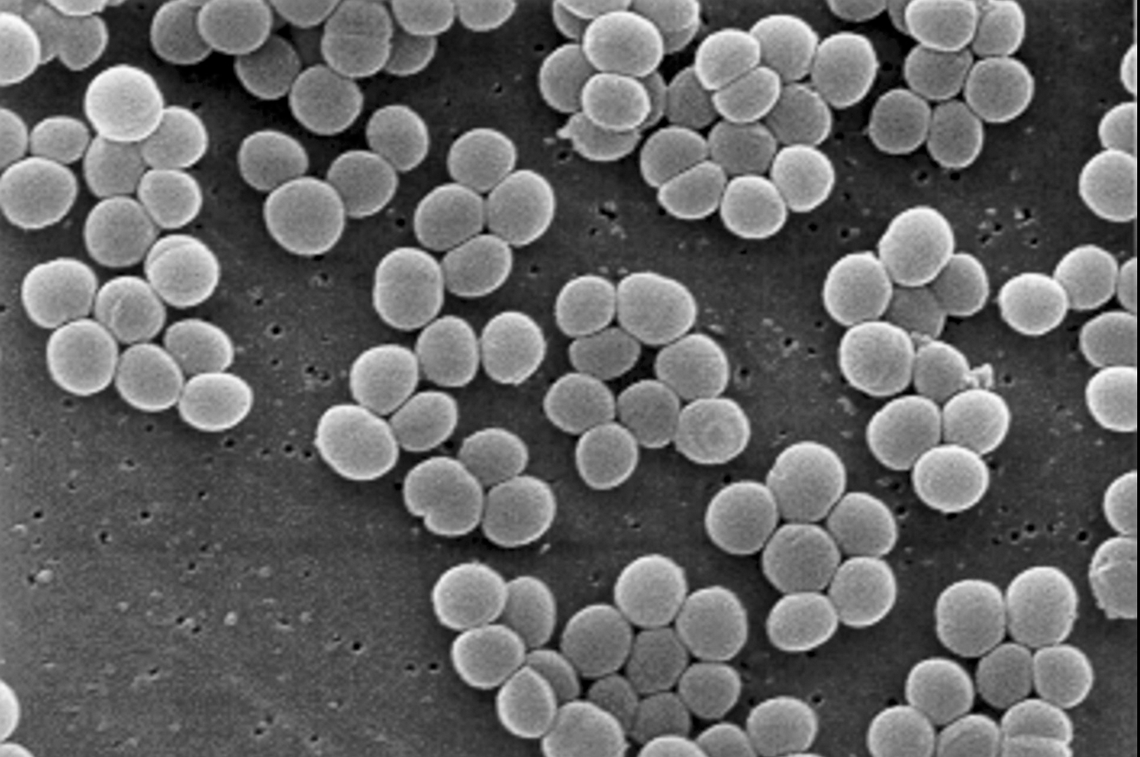 Bushnell-Prairie City HS Addresses Staph Infection Cases Among Students